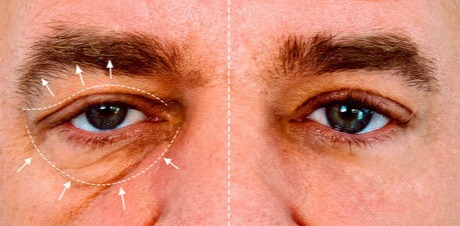 plastic cosmetic surgery by female plastic surgeon Pune