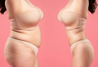 plastic cosmetic surgery by female plastic surgeon Pune